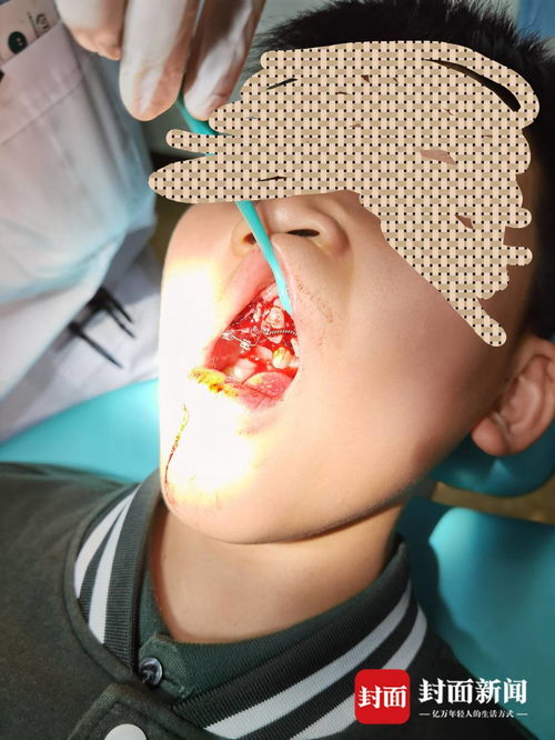 重慶特斯拉車主遭遇驚魂一幕 停車時車輛自動加速撞墻，致孩子受傷